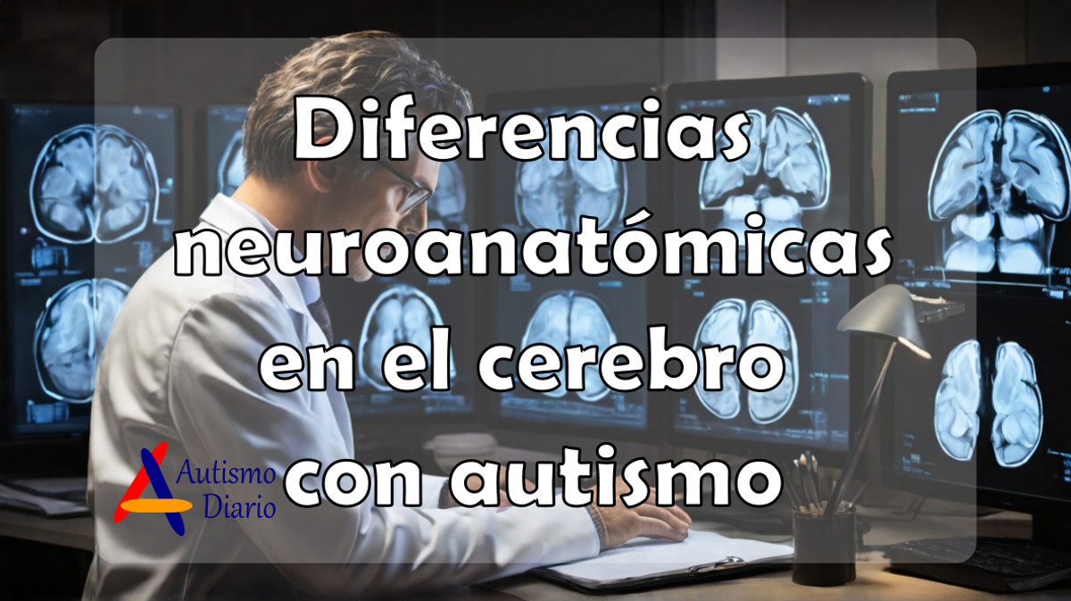 Diferencias neuroanatómicas