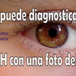 diagnosticar el TDAH con una foto del ojo